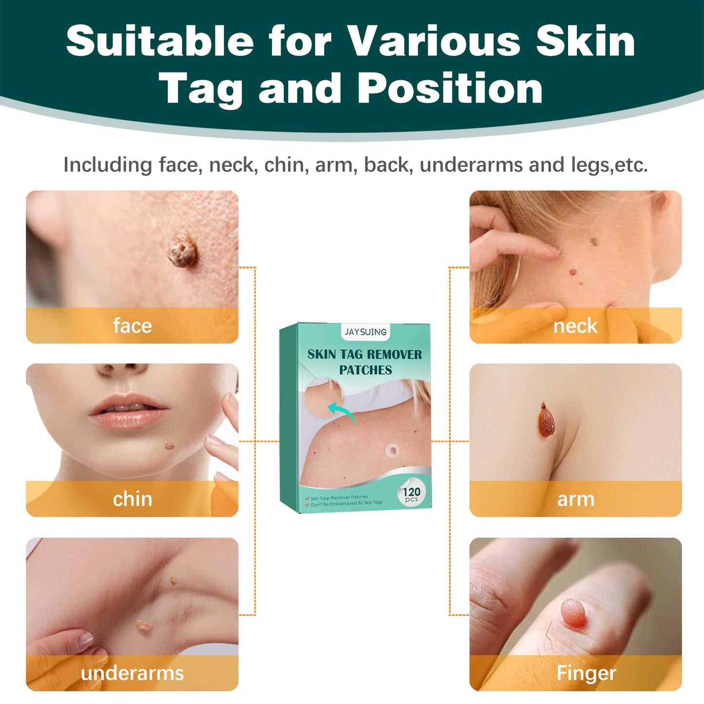 Derma - Skin Tag Remover