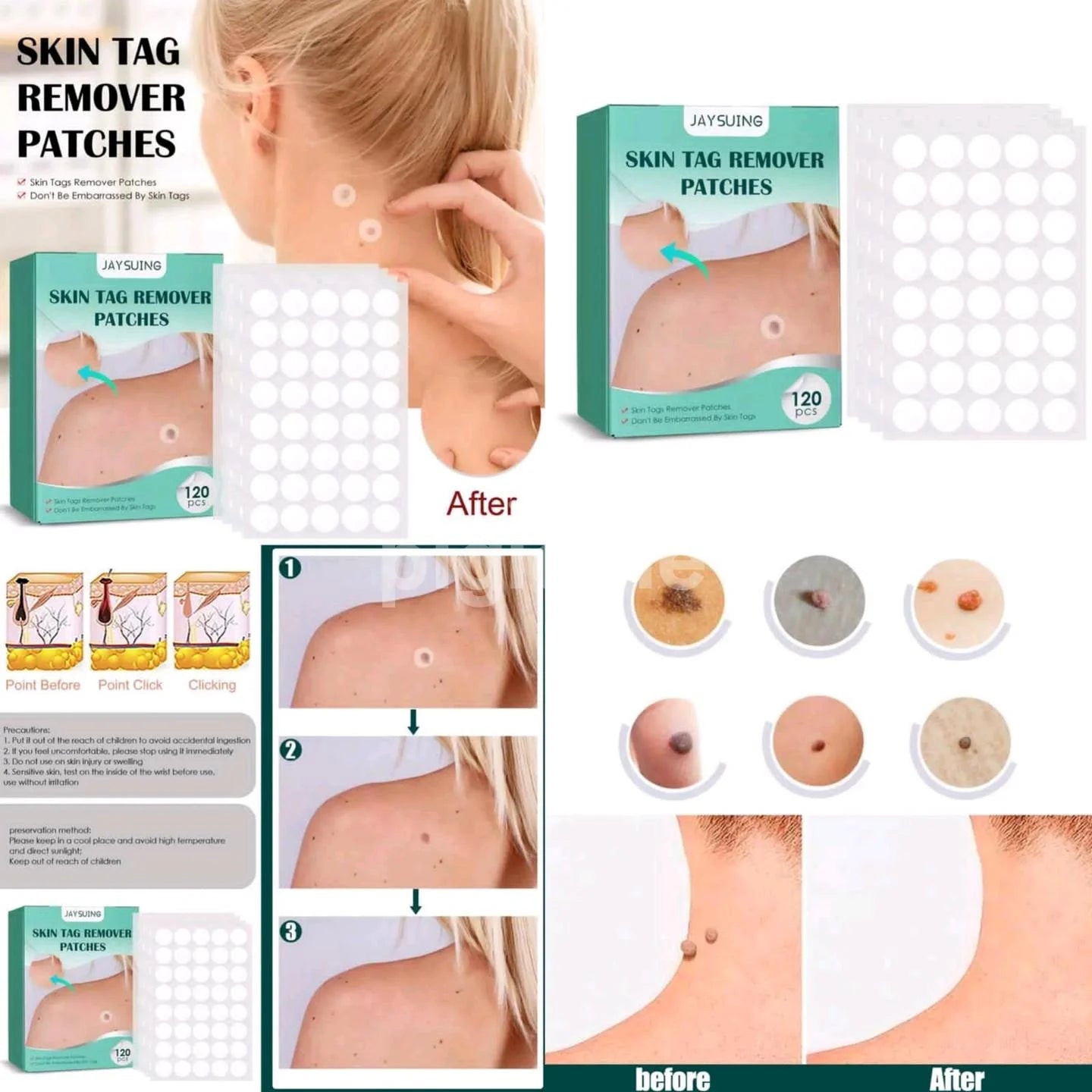 Derma - Skin Tag Remover