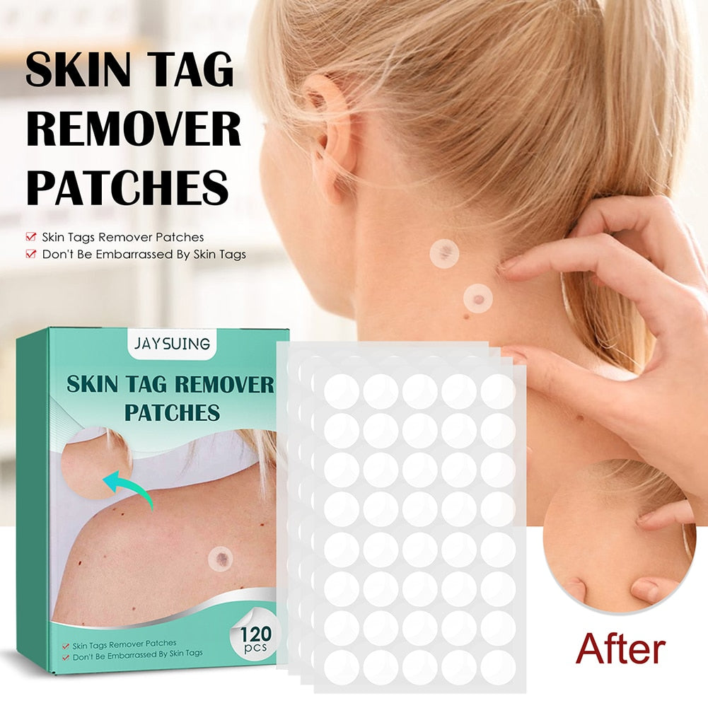 Derma - Skin Tag Remover