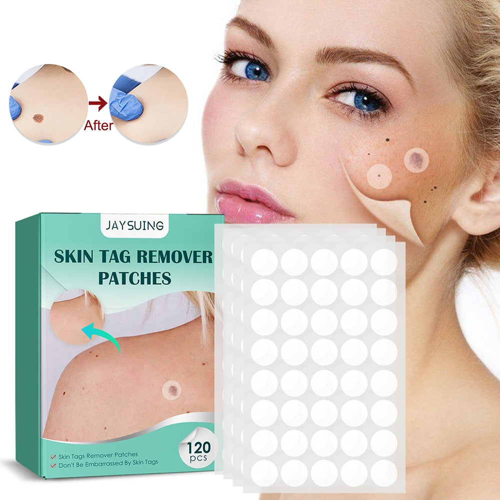 Derma - Skin Tag Remover