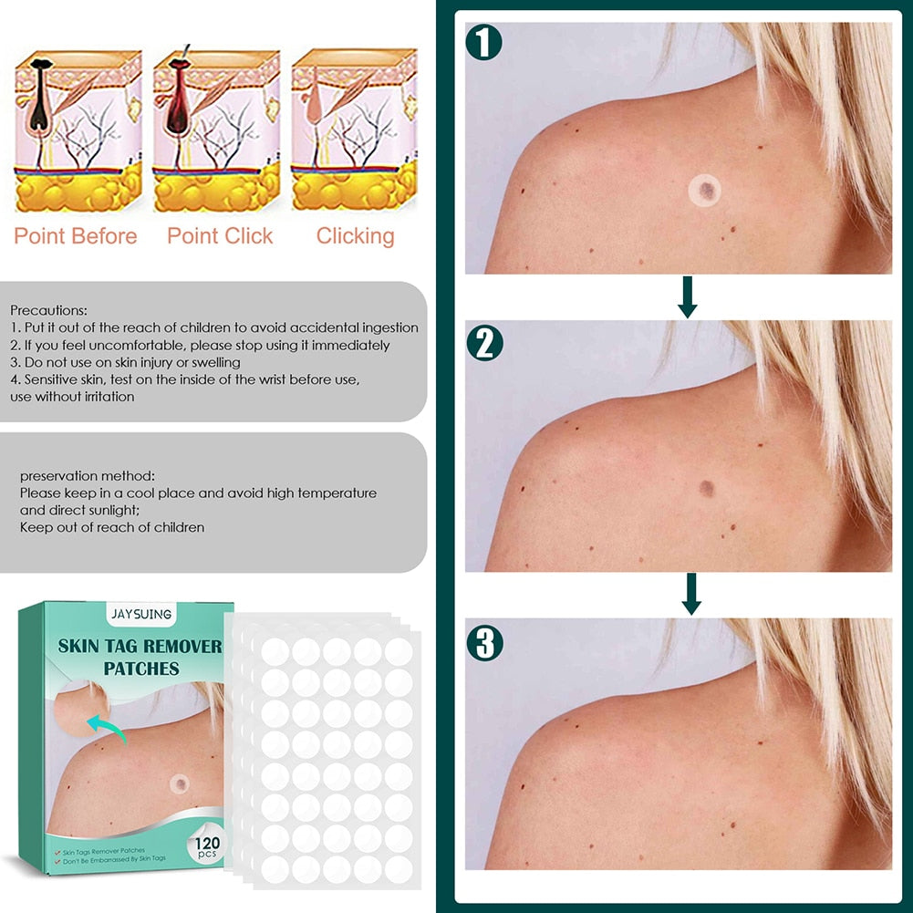 Derma - Skin Tag Remover